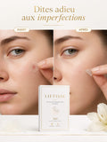 Patchs Anti-Imperfections Invisibles - Pack de 360 Patchs Hydrocolloid