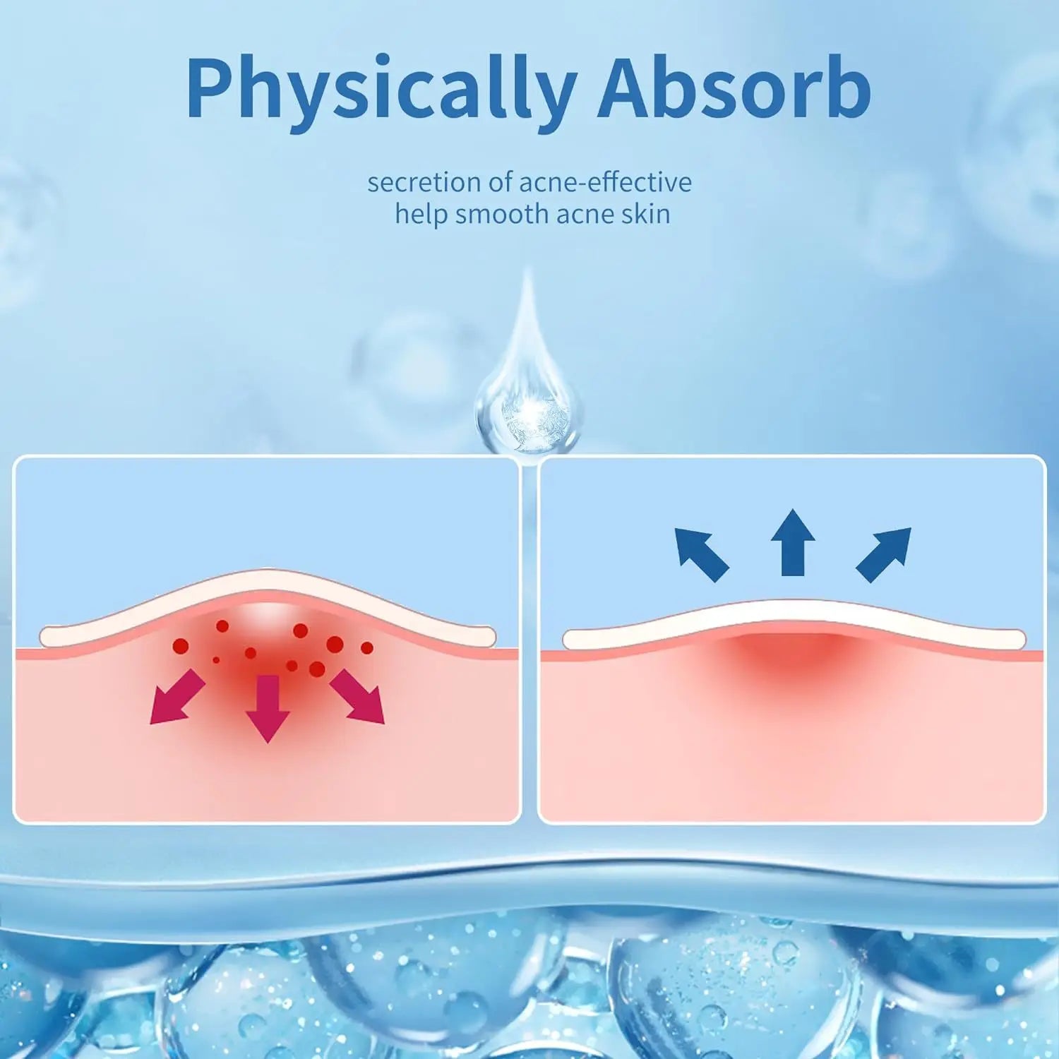 Patchs Anti-Imperfections Invisibles - Pack de 360 Patchs Hydrocolloid