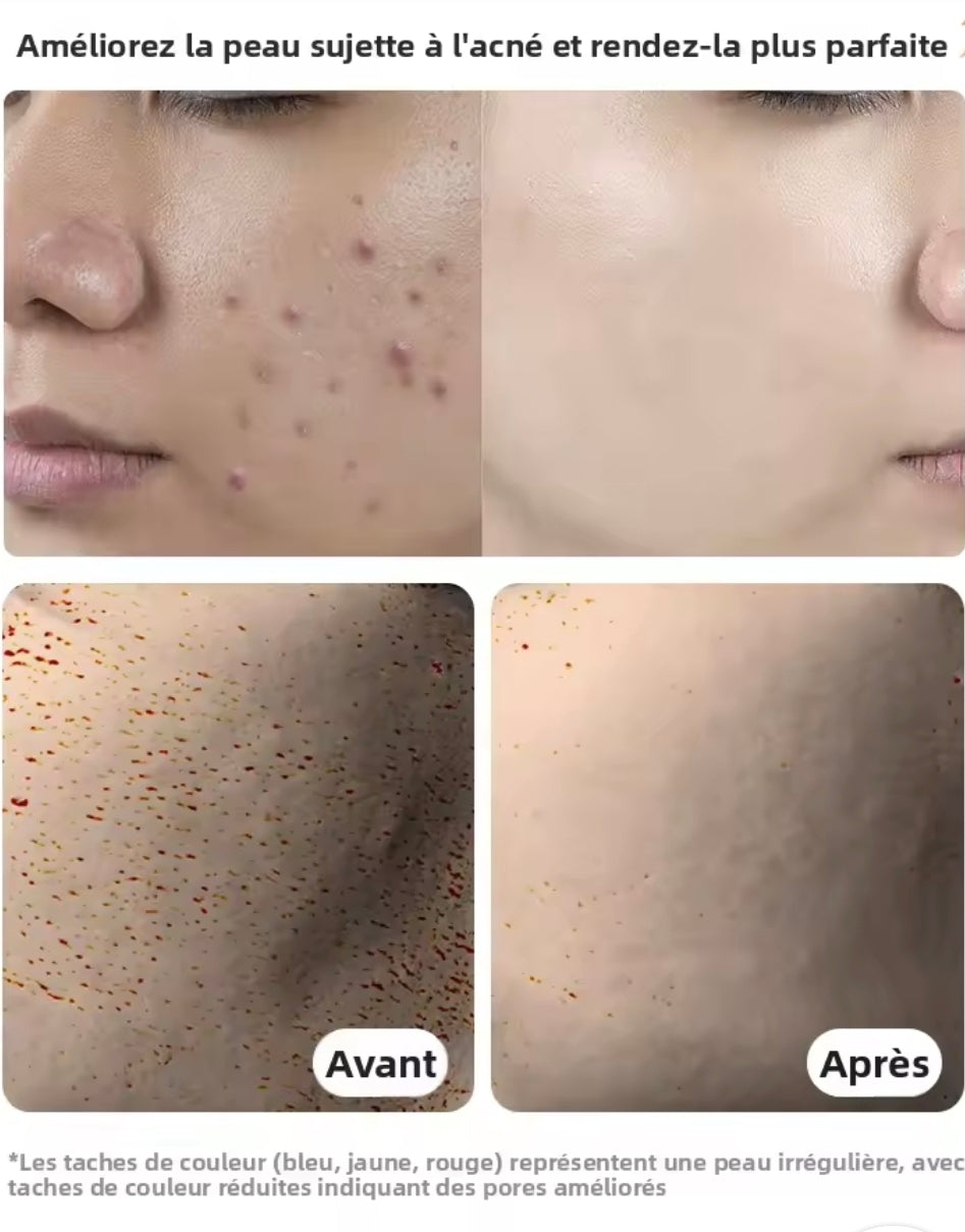 AURALIFT